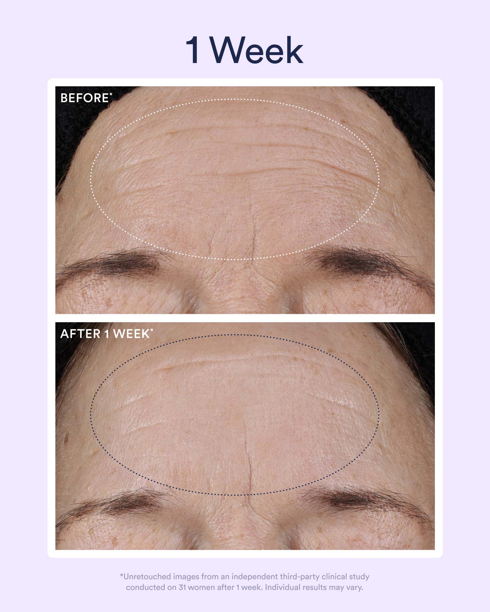 Dream Night Serum with Bio-Retinol